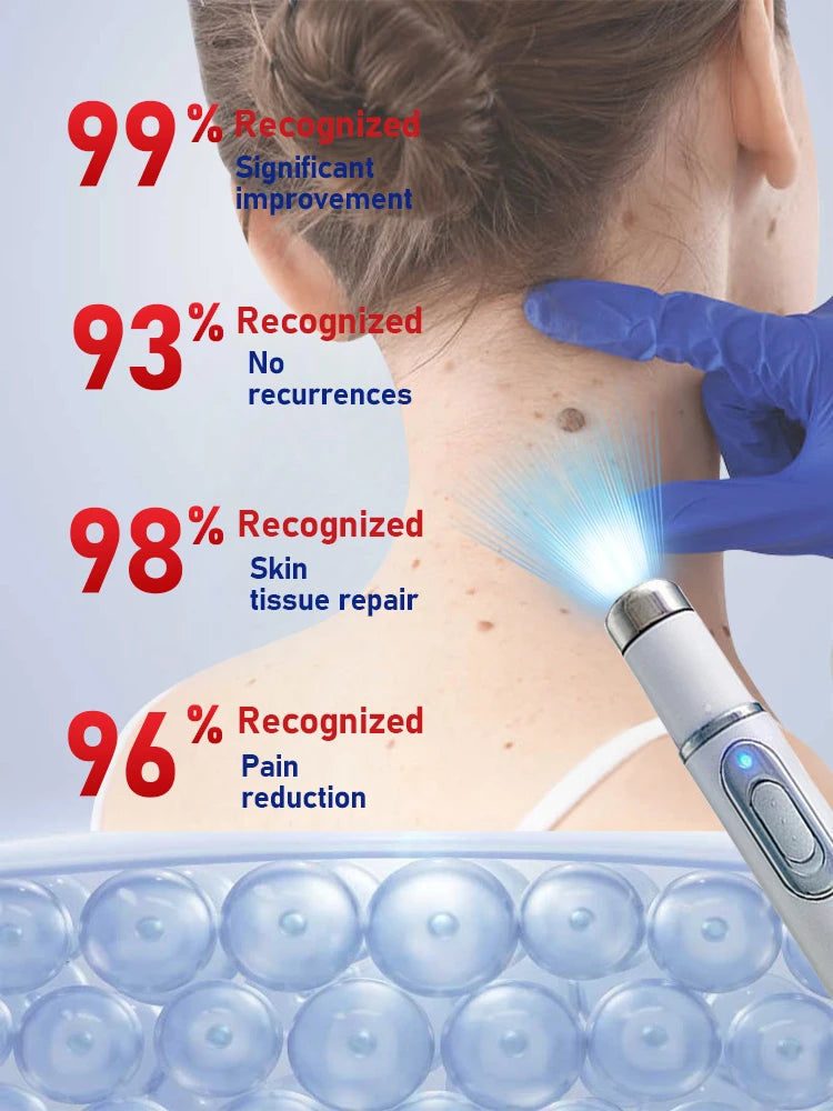 Verruga atualizada de 2a geração reparação de raiz de verrugas uickly 101