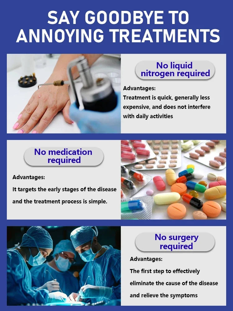 Verruga atualizada de 2a geração reparação de raiz de verrugas uickly 101